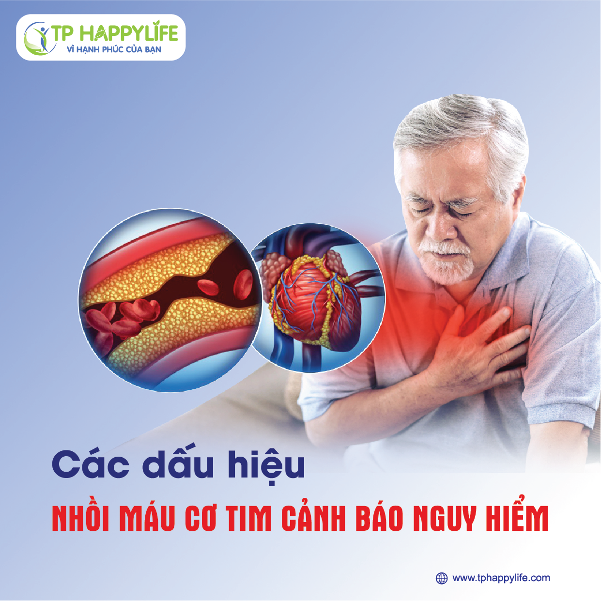 Các dấu hiệu nhồi máu cơ tim cảnh báo nguy hiểm.